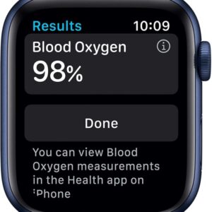 buy apple watch liquidation pallets in Netherlands