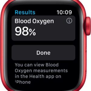 buy apple watch liquidation pallets in Netherlands